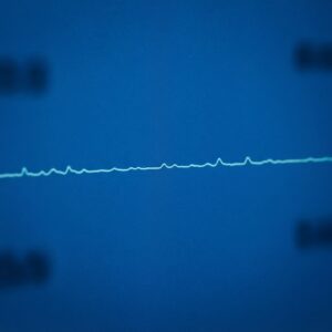 HPLC 감도 부족 관련 이미지